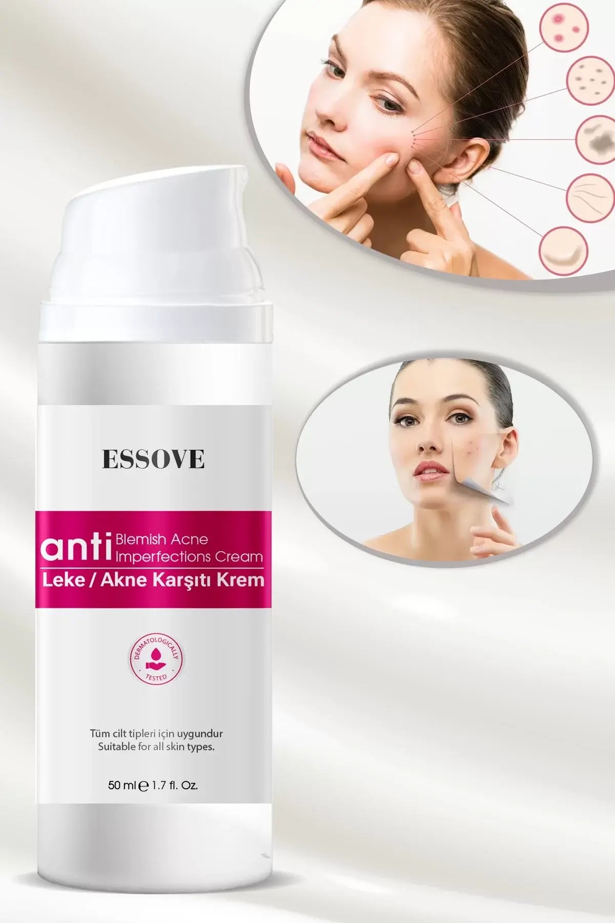 ESSOVE Akne ve Leke Karşıtı Krem 50ml